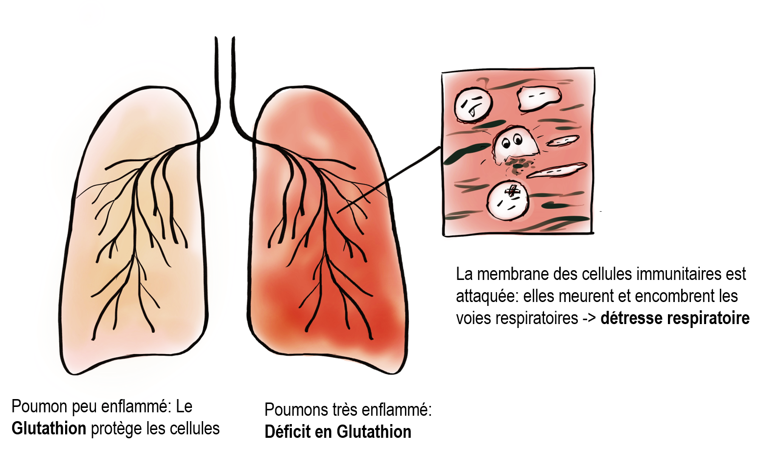 lung french